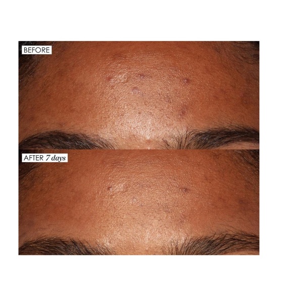 🆕 Sunday Riley Good Genes - Picture 4 of 4